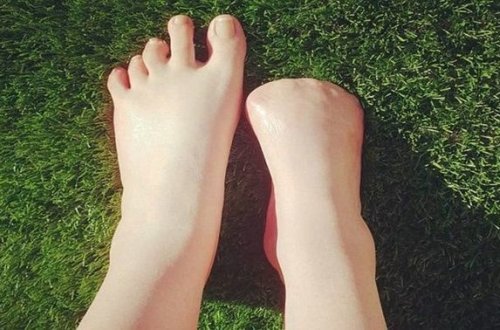 Pedikür avstraliyalı qızı ayaq barmaqlarından etdi