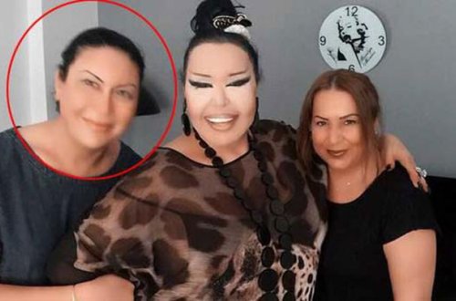 Bülənt Ərsoya bənzəmək üçün 10 əməliyyat keçirdi - Fotolar