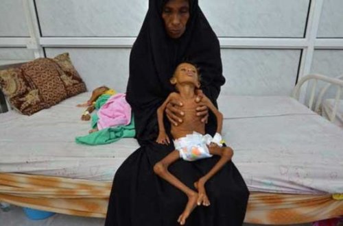 Burada insanlar aclıqdan YARPAQ YEYİRLƏR