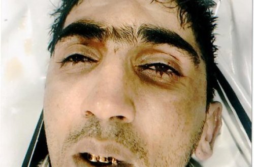 Bulvarda intihar edən şəxsin DƏHŞƏTLİ FOTOSU YAYILDI