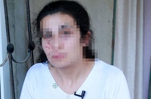 Bakıda zorlanmadan son anda qurtarılan qadın danışdı - VİDEO