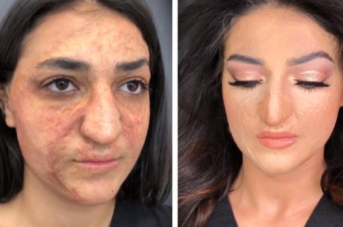 Dünyaya səs salan azərbaycanlı vizajist üzü yanmış xanımı TANINMAZ HALA SALDI - VİDEO