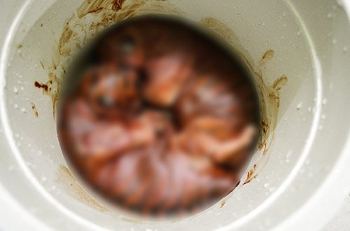 Dəhşətə gətirən görüntülər - Qarnından çıxanlar görənləri şok etdi - FOTOLAR