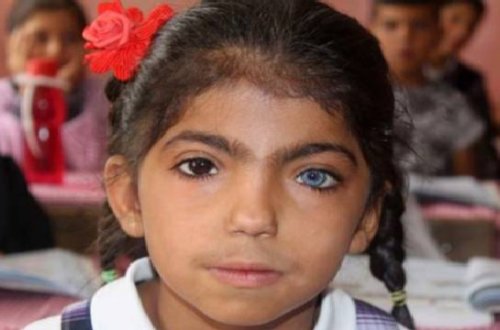 Gözlərini görən çaşqınlıq yaşayır – Fotolar