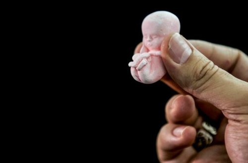 Abort sifarişli qətldir - Papadan ŞOK AÇIQLAMA