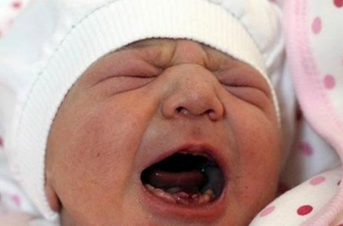 Yeni doğulan körpə hər kəsi şoka saldı: Ağzında 9 dişi var - FOTO