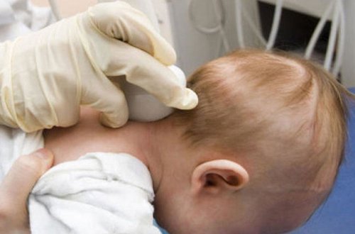 Uşaqlarda nevroloji problemlər və onların fəsadları