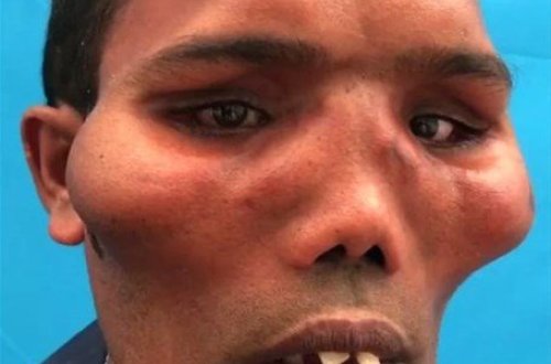 Xəstəliyə tutulan kişinin dərdinə çarə yox idi - 20 ildən sonrakı inanılmaz dəyişimi - FOTO