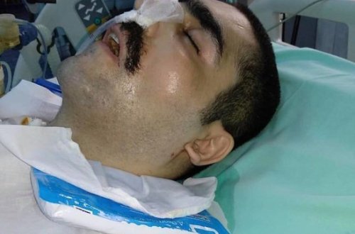 Aprel döyüşlərinin qəhrəmanı komadadır: Vəziyyəti ağırdır - FOTO