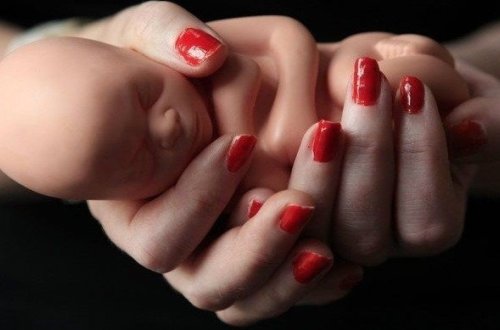 Azərbaycanda 15-17 yaşlı qızlar arasında abort halları artıb - STATİSTİKA