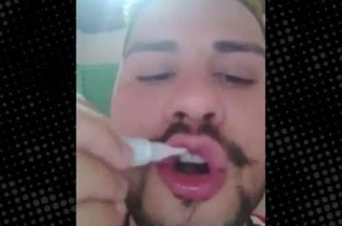 Dodağına yapışqan sürtüb, sevgilisi ilə öpüşdü, ayıra bilmədilər - VİDEO