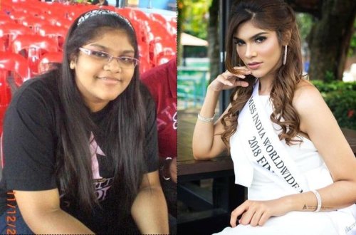 “Çirkin ördək balası” deyə lağa qoyulan qız dünya gözəli oldu - Fotolar