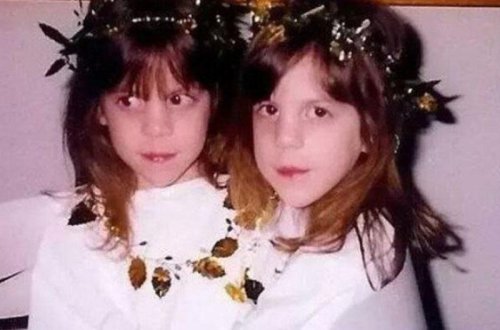 Əkiz bacılar cinsiyyətlərini dəyişib oğlan oldular - FOTO