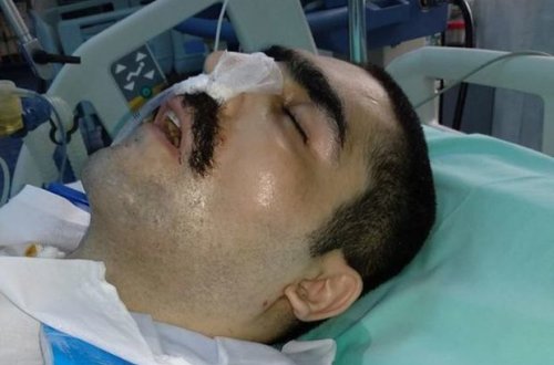 Qoşqar Hacıyevin vəziyyəti kəskin pisləşib