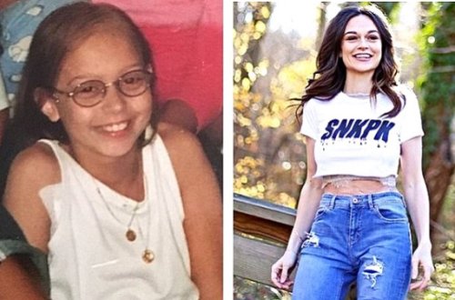 11 yaşında ayağı kəsilən qız böyüyüb məşhur model oldu — FOTOLAR