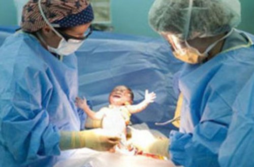 Əkiz uşaq dünyaya gətirdi, amma hər ikisi... - Azərbaycanda ŞOK HADİSƏ