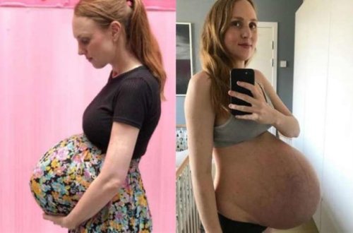 Qarnını görənlər inana bilmirlər - FOTOLAR