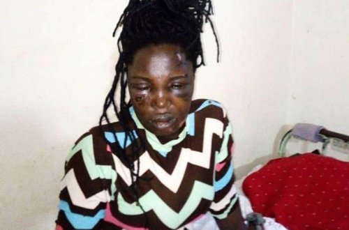 Qadın fahişə yanına gedən sevgilisini kişilikdən məhrum etdi - FOTO