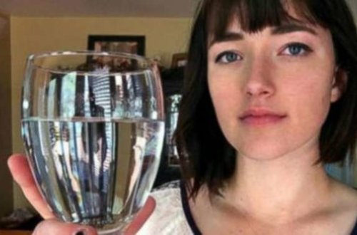 17 yaşlı qız yer üzündəki ən dəhşətli xəstəliklə mübarizə aparır - FOTO