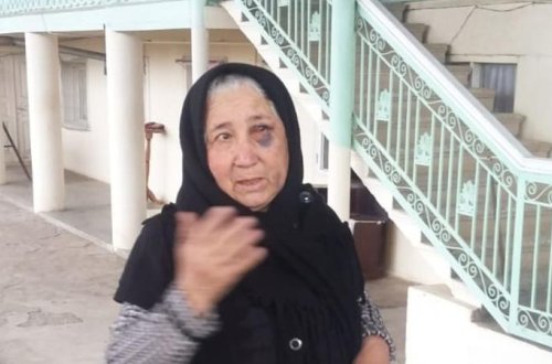 Azərbaycanda gənc oğlanlardan yaşlı qadına qarşı İYRƏNC HƏRƏKƏT - FOTO