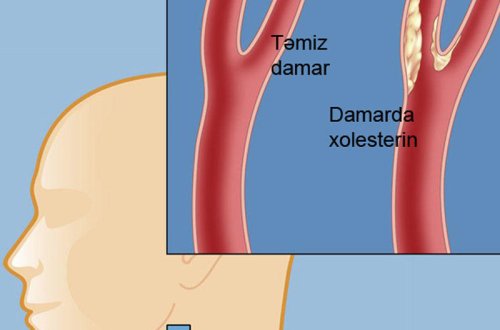 Xolesterinin və yüksək təzyiqin birinci düşməni - hər gün 1 ovuc yeyin!