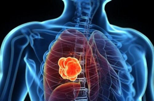 Azərbaycanda ŞOK HADİSƏ: 5 yaşından yanlış diaqnozla müalicə aldı, 21 il sonra...