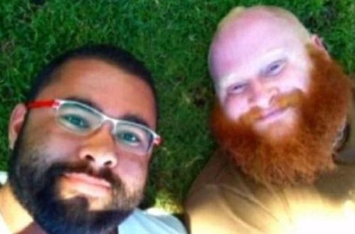 Genital bölgəsinə silikon qoyduran kişi öldü - FOTO