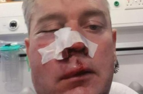 Futbolçular və azarkeşlər hakimin çənəsini sındırdılar