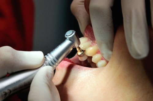 “Stomatoloji kabinetlərdə QİÇS təhlükəsi var” - HƏKİM