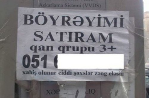 Azərbaycanda orqanlarını satışa çıxaranlara icazə var? – Video