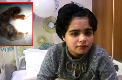 11 yaşlı qızın mədəsindən çıxanlar həkimləri şok etdi - FOTOLAR