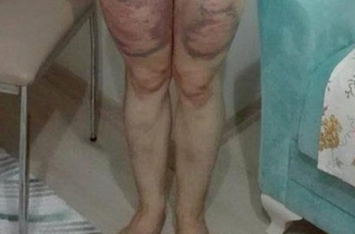 Arvadının başqa kişi ilə mesajlaşdığını gördü - Keç otağa, soyun - FOTO