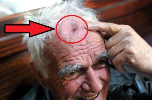 Başından çıxana inanmayacaqsız - Adı Ginnesin Rekordlarına düşdü - Video