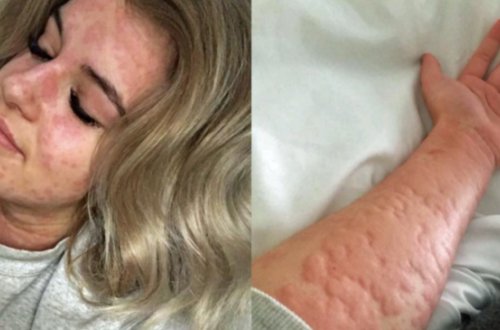 21 yaşlı qızı havaya çıxa bilmir - İNANILMAZ SƏBƏB