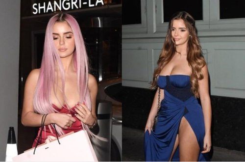 25 yaşlı model imicini dəyişdi - Fotolar