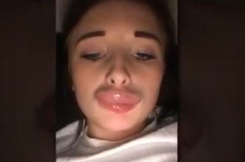 Dodaqlarını silikon etdirdi, tanınmaz hala düşdü - Şok FOTOLAR