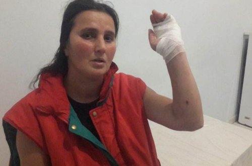 Sumqayıtda qonşu qadınlar arasında bıçaqlaşma olub - FOTO