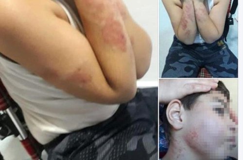 Özəl Mərkəzdə VƏHŞİLİK: Əlil uşağı döyüb bu hala saldılar - FOTOLAR