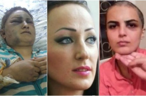 Başqa kişi ilə tutduğu arvadının əl qolunu bağlayıb qulağını kəsdi, başını qırxdı - Azərbaycanda ŞOK