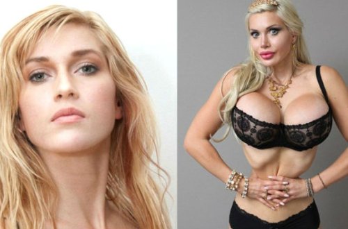 200-dən çox plastik əməliyyat keçirən qadının son istəyi həkimləri şoka saldı — FOTOLAR