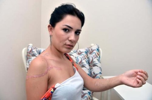 ŞOK HADİSƏ: Həkim gənc qızı bu hala saldı - FOTOLAR