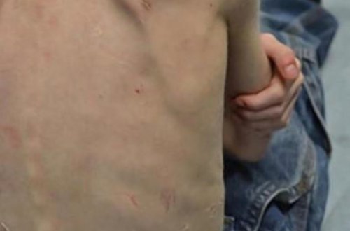 Ögey atası və qardaşı 5 yaşlı uşağa zülm etdi: Dolaba salıb günlərlə ac saxladılar və... - FOTOLAR