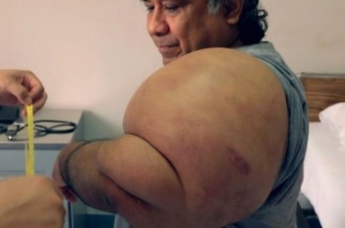 Bədəni birdən şişməyə başladı, səbəbini biləndə həyatının şokunu yaşadı - FOTOLAR