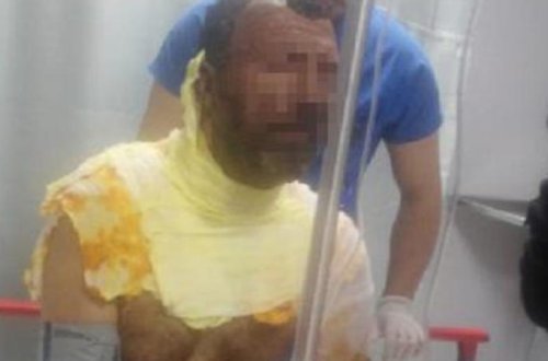 Kişi özünü yandırdı: Arvadımla... – Səbəbi sizi ŞOKA SALACAQ