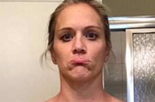 4 il əvvəl əməliyyata girən qadının sinəsi bu hala düşdü - FOTO