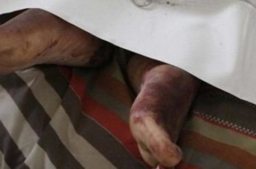 Azərbaycanda dəhşətli HADİSƏ: vəhşi heyvanlar evə soxulub KİŞİNİ PARÇA-PARÇA ETDİ