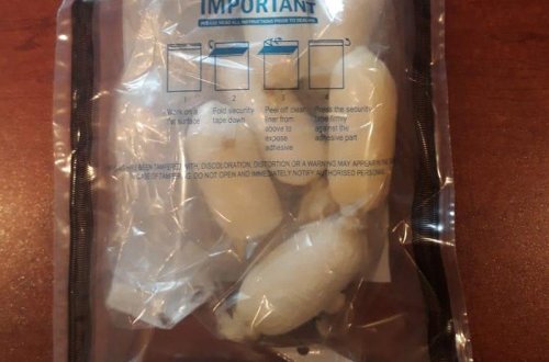 İran vətəndaşı Azərbaycana düz bağırsağında narkotik keçirmək istədi