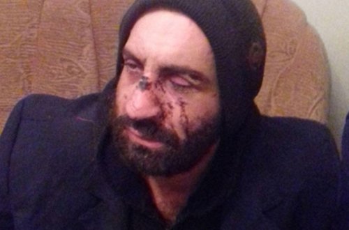 Quba sakinini meşədə vəhşicəsinə döydülər