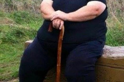 127 kq arıqladı, ölümdən qurtuldu - FOTO