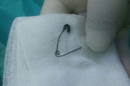 İynə udduqda orqanizmdə nə baş verir?